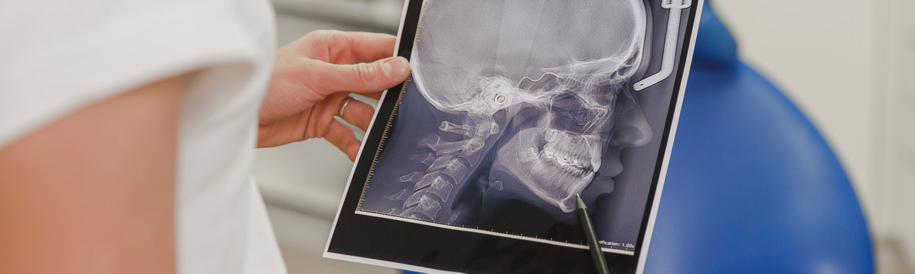 The Bite Process with OrthoSport Canada